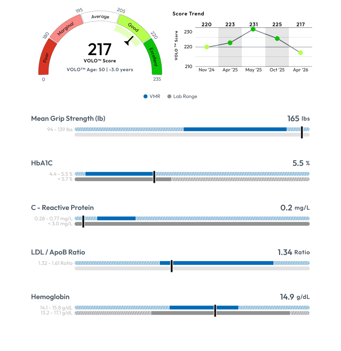 Brain health visualization